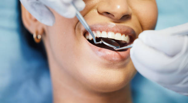 Best Emergency Tooth Extraction in Lawton, MI